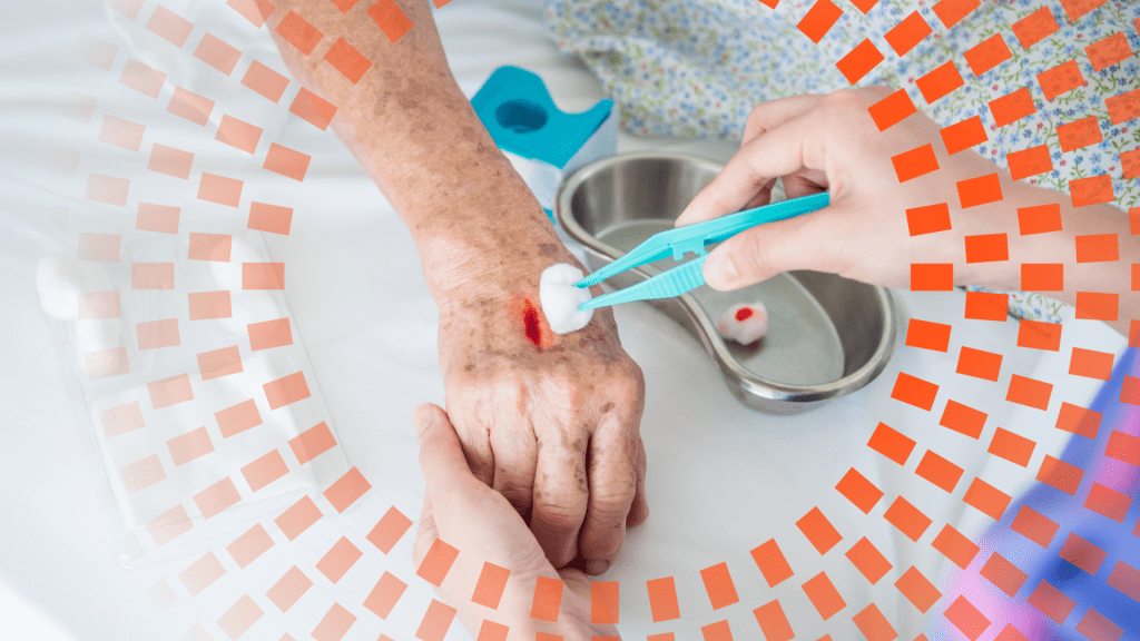 Hemostasia y mecanismos de la coagulación sanguínea